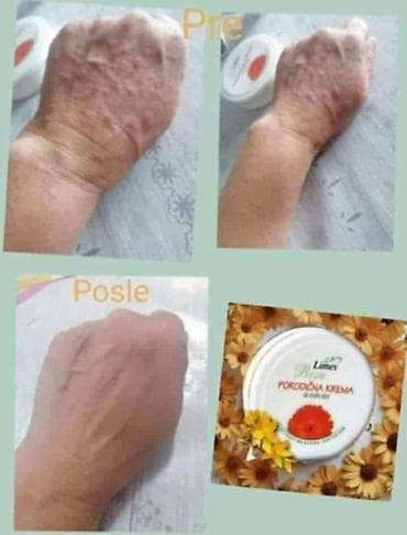 ps bluze i majice: Limes Rosa Porodična krema – kantarion i neven Višenamenska krema za — 5