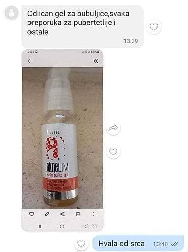 sinsay kožne jakne: Aknelim gel 30ml – 100% delotvoran saveznik protiv akni Iskoristite — 9