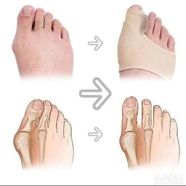 nautubone gel: Footmate Toe Supporter – gel jastučići za prednji deo stopala sa — 1