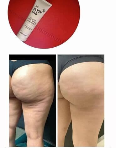 naramenice cena: ✨ Zategnuta koža i glatke noge nisu više san! Uz The Body Lab — 2