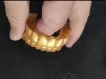 enzo i lorenzo koferi iskustva: Najnoviji Snap on Smile u gold izdanju!!! Cena:1900din (Gornja ili — 4