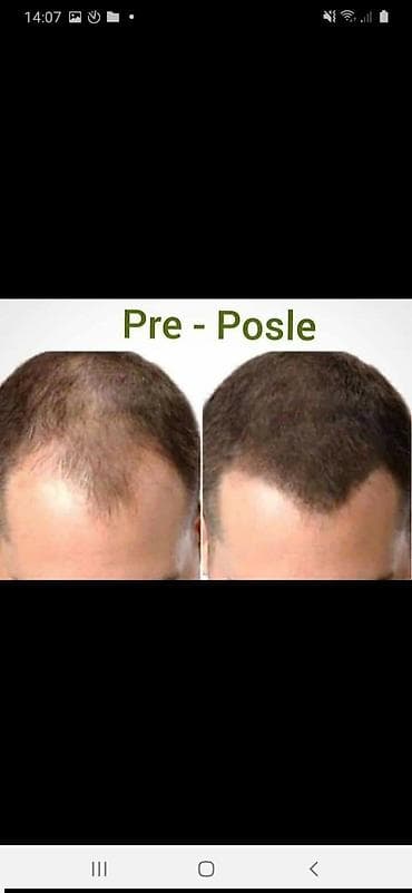 Beauty & Care: Kondicionirajući šampon za kosu – “Power and Protection Hair” (500 ml) — 3