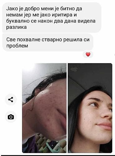 sinsay kožne jakne: Aknelim gel 30ml – 100% delotvoran saveznik protiv akni Iskoristite — 7