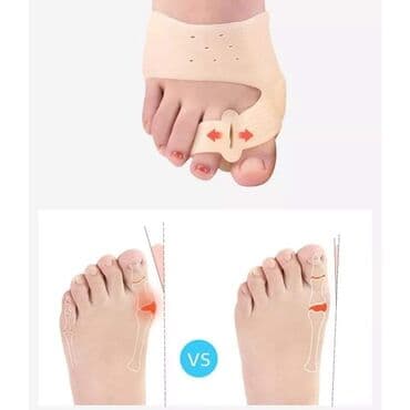 separator za čukljeve dm cena: 1000din Korektor za ispravljanje cukljeva i otklanjanje bolova sa — 2