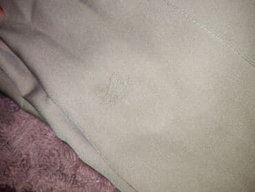 Trenerke: Ženske farmerke – nekoliko para Cena za dva para koju imaju ostecenja — 23