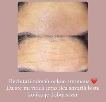 najk znak: 24k gold serum za lice s aktivnim kolagenom svilene niti cena:3400din — 6