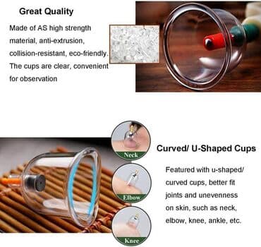 Ventuze . CUPPING-fizikalna terapija-akupunktura- čašama Komplet za — 2