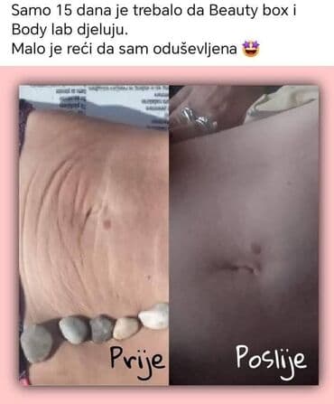 naramenice cena: ✨ Zategnuta koža i glatke noge nisu više san! Uz The Body Lab — 15