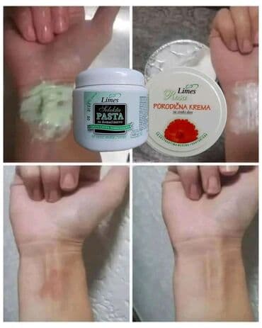 Muška odeća: 🔥▪️▪️▪️Opekli ste se?▪️▪️▪️🔥 ▪️Nije vreme za paniku 🌿▪️Limes nudi — 1