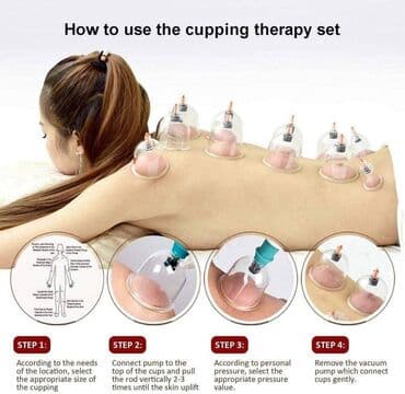 Ventuze . CUPPING-fizikalna terapija-akupunktura- čašama Komplet za — 10