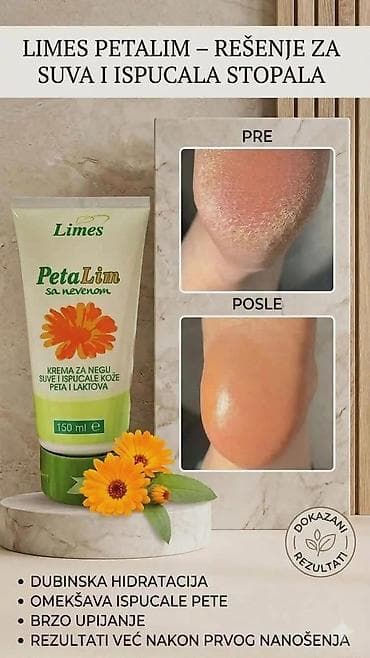 sorts i kosulja: Limes PetaLim krema sa nevenom – intenzivna nega za suvu i ispucalu — 1