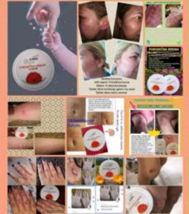 ps bluze i majice: Limes Rosa Porodična krema – kantarion i neven Višenamenska krema za — 4