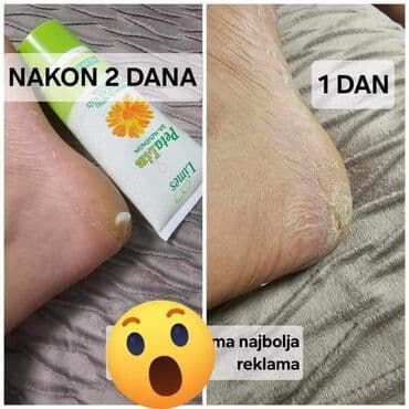 nutriplus vitamin c: Zadovoljni kupci su naša najbolja reklama 👌👌👌 — 1