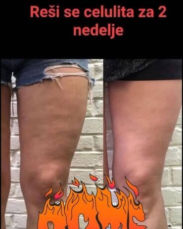 naramenice cena: ✨ Zategnuta koža i glatke noge nisu više san! Uz The Body Lab — 4