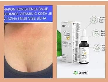 balea beauty expert: Vitamin C je sastojak koji je postao nezaobilazan korak u svakodnevnoj — 1