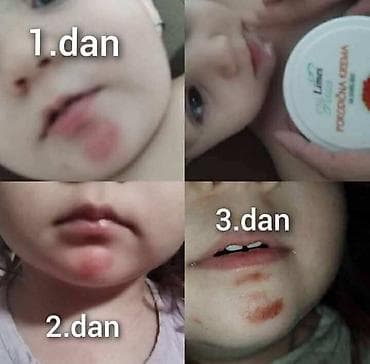 ps bluze i majice: Limes Rosa Porodična krema – kantarion i neven Višenamenska krema za — 9