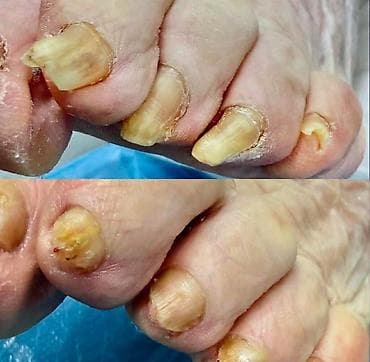 maseri beograd: ✨ FootCare Beograd ✨ Premium nega stopala u samom centru grada 👣 — 4