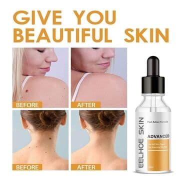 eucerin akcija 1 1 cena lilly: Cena 890 dinara Sredstvo za uklanjanje bradavica PREDNOSTI: 1 — 7