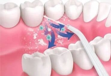 Auto elektronika: Prenosni oralni irigator – „Tooth cleaner“ - 3 režima čišćenja: Weak — 5