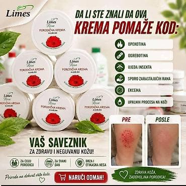 Ide leto,deca su u majicama i sorcicima. Padovi sa