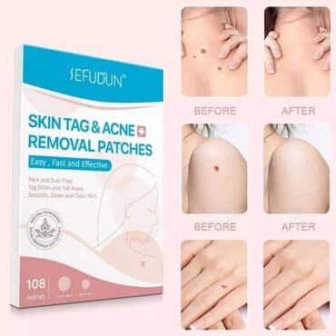 Cena 940 din Flasteri za uklanjanje bradavica/akni 108 komada