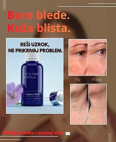 bele kožne sandale: Experalta Lift & Firm Ampoule – “prirodan botoks” na biljnoj bazi — 5