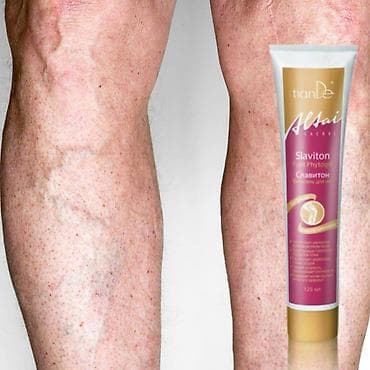 flaster protiv bolova: Slaviton fitogel za noge i vene Ekstrakt divljeg kestena jača zidove — 4