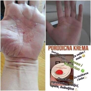 deda mraz iznajmljivanje deda mraza i kostima deda mraza београд – слике: Породична КРЕМА НА биљној бази! ☝️🌿☘️☘️🌿💪 * Против опекотина; 👌/ 🔥 * — 1