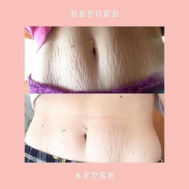 la rive parfemi: Anticelulit gel – The Body Lab Cellulite Spot Topical Concentrate — 2