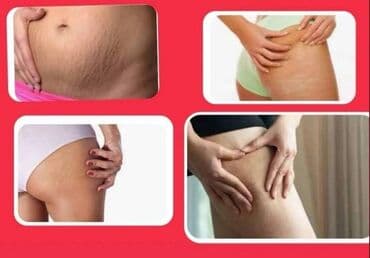 naramenice cena: ✨ Zategnuta koža i glatke noge nisu više san! Uz The Body Lab — 14