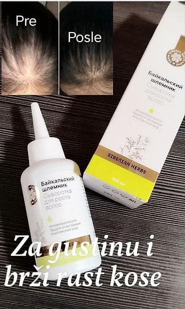 nakit za glavu: Serum za rast kose – Protiv opadanja | Gušća i jača kosa Muči vas — 1
