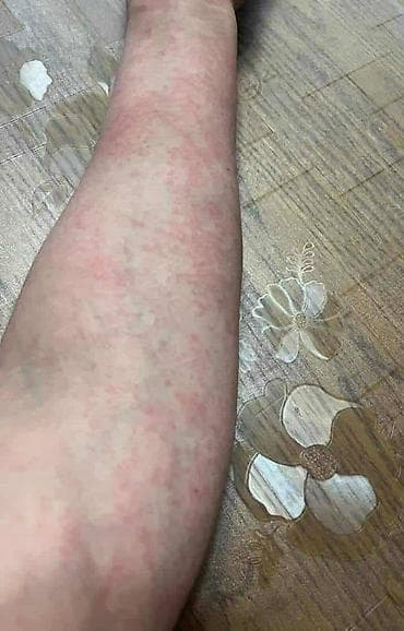 zenske kozne helanke: Ide leto,deca su u majicama i sorcicima. Padovi sa — 6
