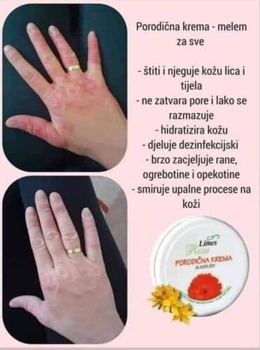 muske jakne za zimu new yorker: Porodicna krema🌼🌼🏖🏖 Prva pomoc gde god da ste👌 Bez nje ne smete biti🍀 — 5