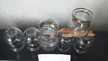 silikonski flasteri za usi: Ventuze ventuza staklena hidže cuping "Ventuze su terapeutski alati — 7
