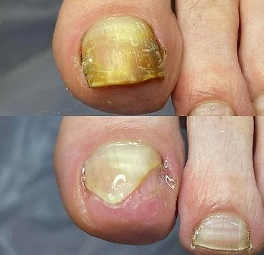 maseri beograd: ✨ FootCare Beograd ✨ Premium nega stopala u samom centru grada 👣 — 6