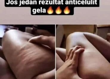 muske jakne za zimu new yorker: 🔥Vreme je da koža prodiše!🔥 Zategnuto. Glatko. Samopouzdano — 1