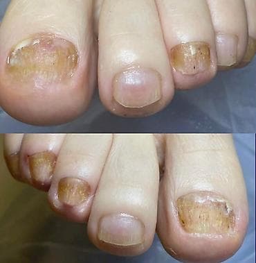 maseri beograd: ✨ FootCare Beograd ✨ Premium nega stopala u samom centru grada 👣 — 5