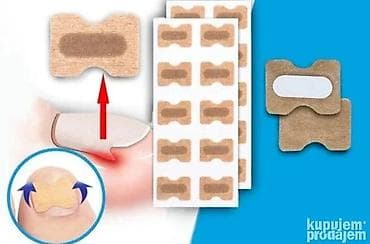 Flasteri za urasle nokte – korektivne trakice za podizanje ivica nokta