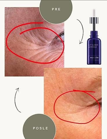 bele kožne sandale: Experalta Lift & Firm Ampoule – “prirodan botoks” na biljnoj bazi — 2