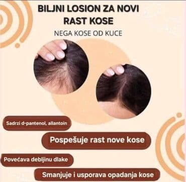 kutije za nakit novi sad: KosaLim 💚 Kosalim je kombinacija prirodnih ekstrakta lekovitog bilja — 8