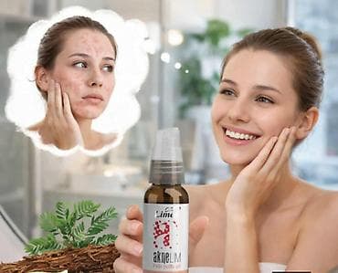 sinsay kožne jakne: Aknelim gel 30ml – 100% delotvoran saveznik protiv akni Iskoristite — 2