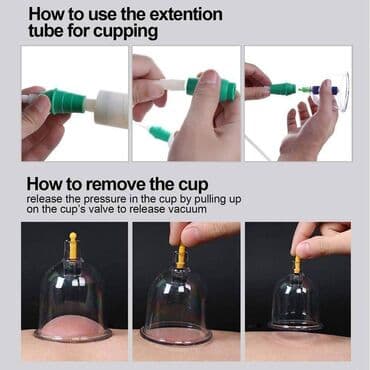 Ventuze . CUPPING-fizikalna terapija-akupunktura- čašama Komplet za — 12