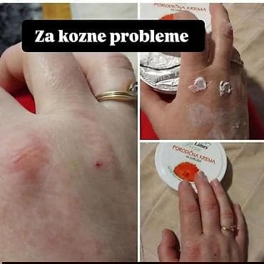 Nega kože: Nemojte ići na plažu bez ove kreme 🤗 🌿 PORODIČNA KREMA – melem koji — 5
