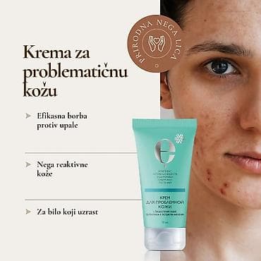 Krema za problematičnu kožu – prirodna nega lica - Efikasna borba