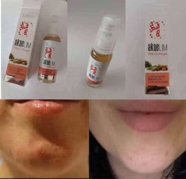 AkneLim gel za čistu kožu u pakovanju sa pumpicom i pripadajućom