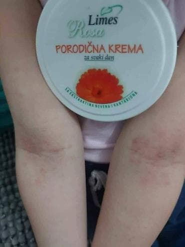 zenske kozne helanke: Ide leto,deca su u majicama i sorcicima. Padovi sa — 9