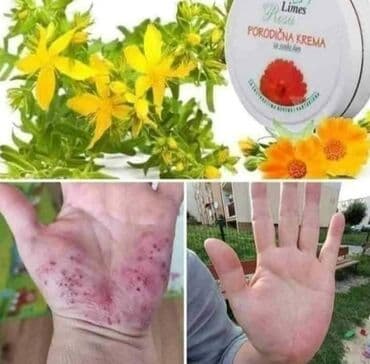 silikonske torbe za plazu: Porodična krema Limes – univerzalna krema za negu kože za ceo dan. - — 1