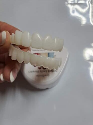 šminke za devojčice: Snap on Smile navlake za zube
Cena:2100din/par — 5