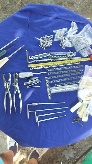 ventuze cena: Osteosintetski materijal. Pločice i šarafi za sastavljanje kostiju — 1