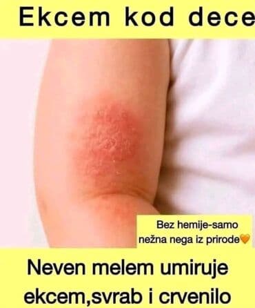 avona nova: ❤PORODIČNA_KREMA❤ 💯JEDAN OD NAJPRODAVANIJIH PROIZVODA 👉Štiti i — 1